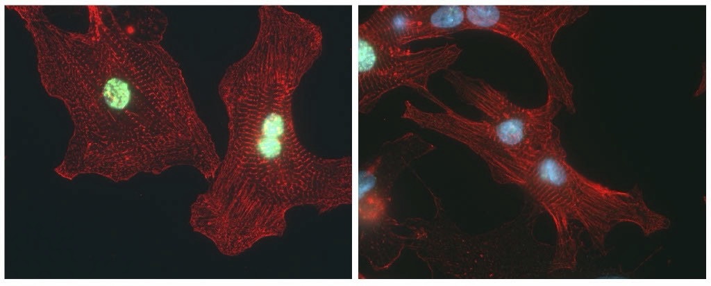 &gamma;H2AX-F&auml;rbung von DNA-Sch&auml;den